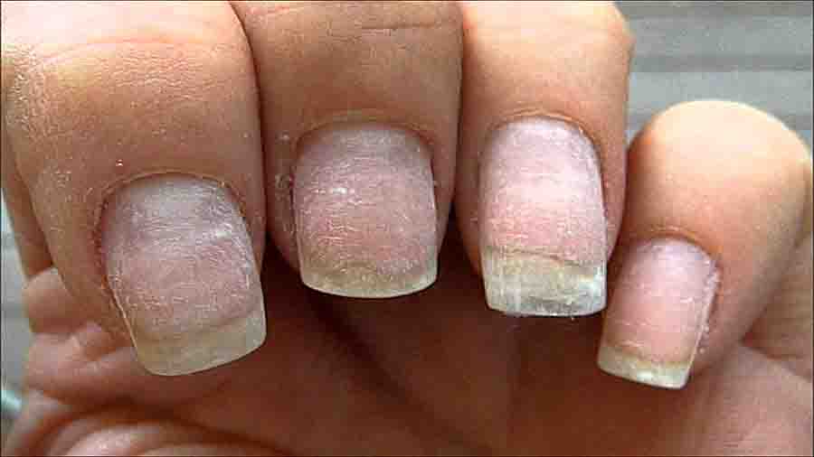 AVOID NAIL DAMAGE WITH PROPER GEL-POLISH REMOVAL | Polished by Crystal